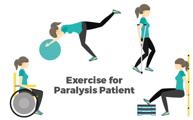 Exercise For Paralysis Patient