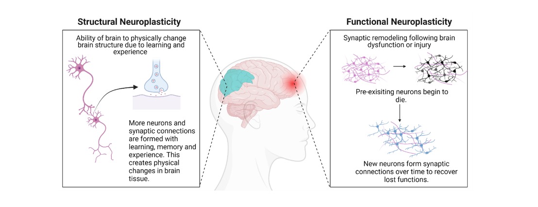 Neuroplasticity How the Brain Heals