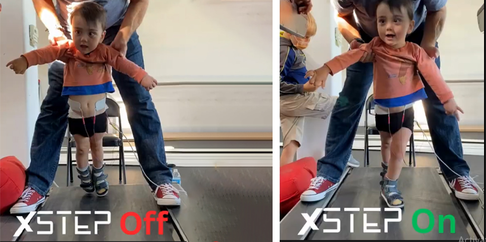 xStep